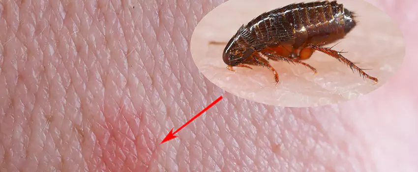 Flea Control for Humans Fontana, CA